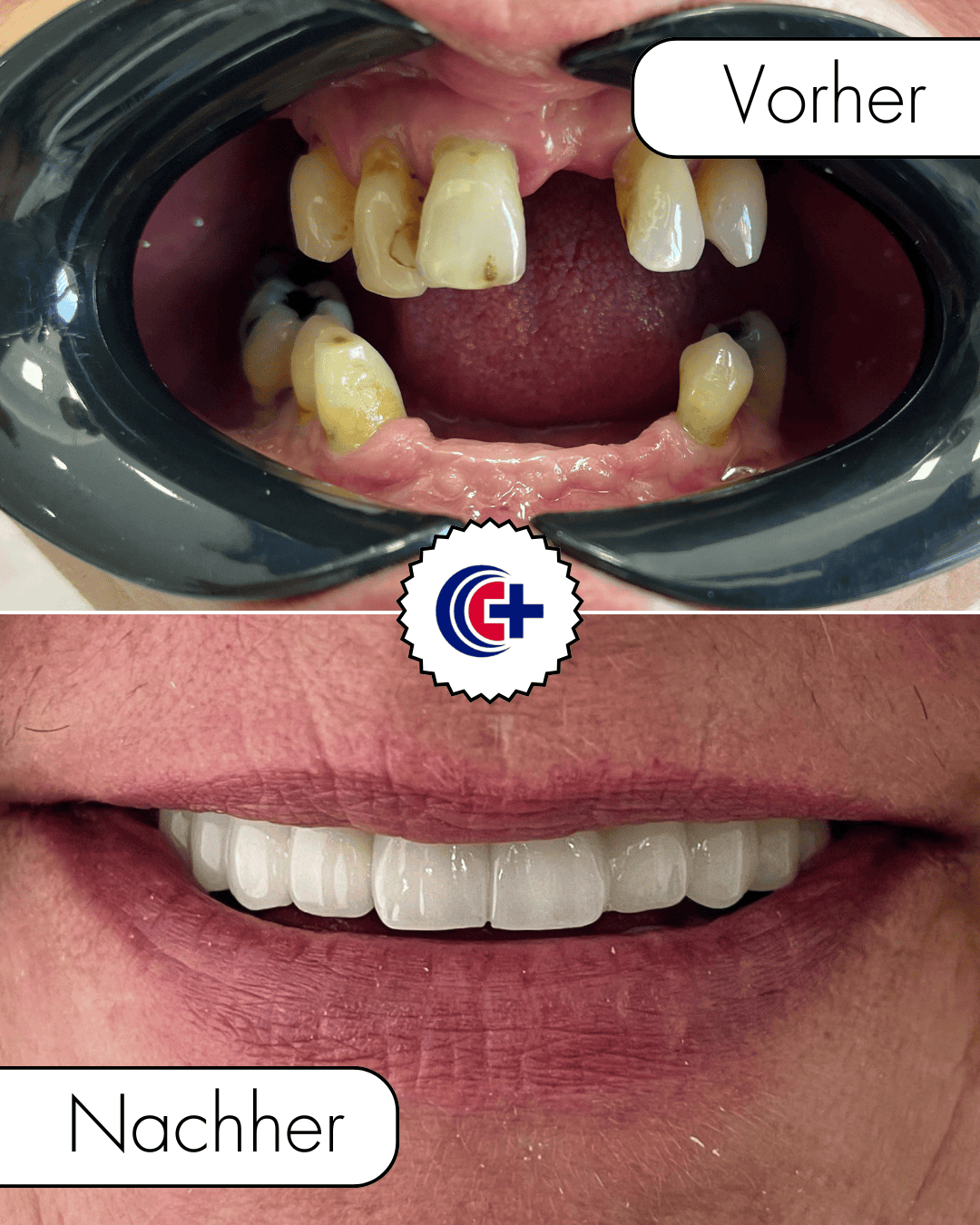 teeth before after 3