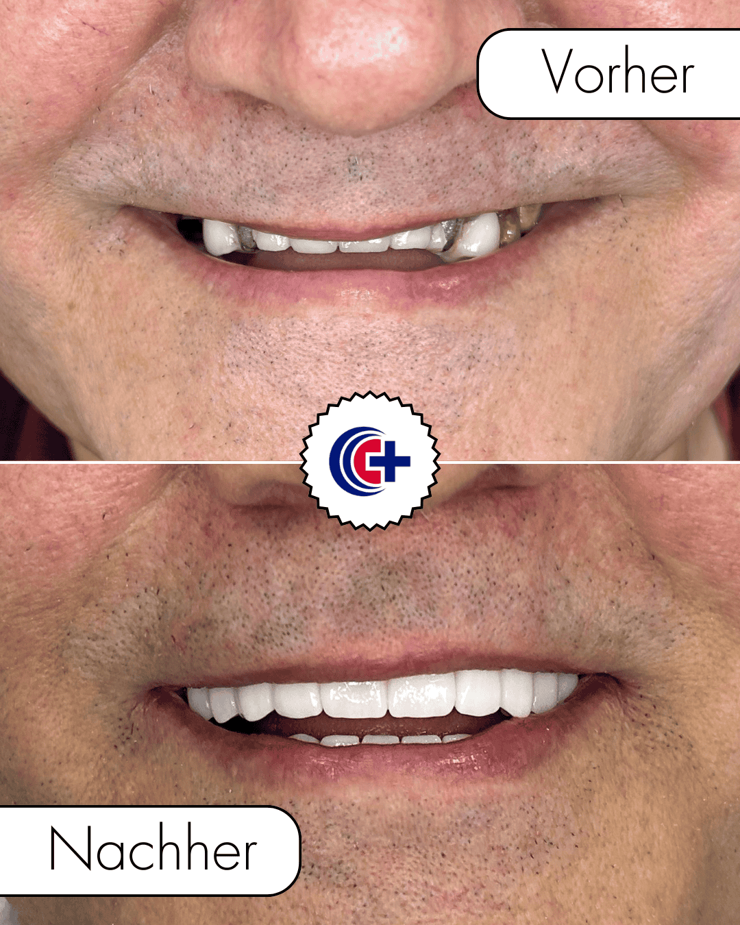 teeth before after 5